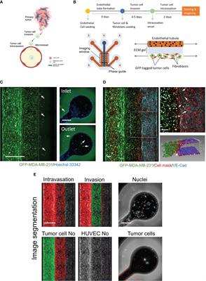 Development of a cancer metastasis-on-chip assay for high throughput drug screening